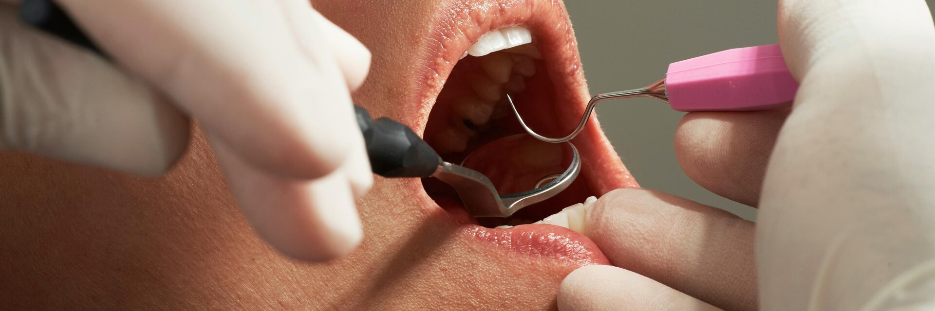 Zahnarzt | caroline-lm-unsplash | © caroline-lm-unsplash DDr. Christof  Ruda (Facharzt für Zahn-, Mund und Kieferheilkunde - Impression #1 | © caroline-lm-unsplash